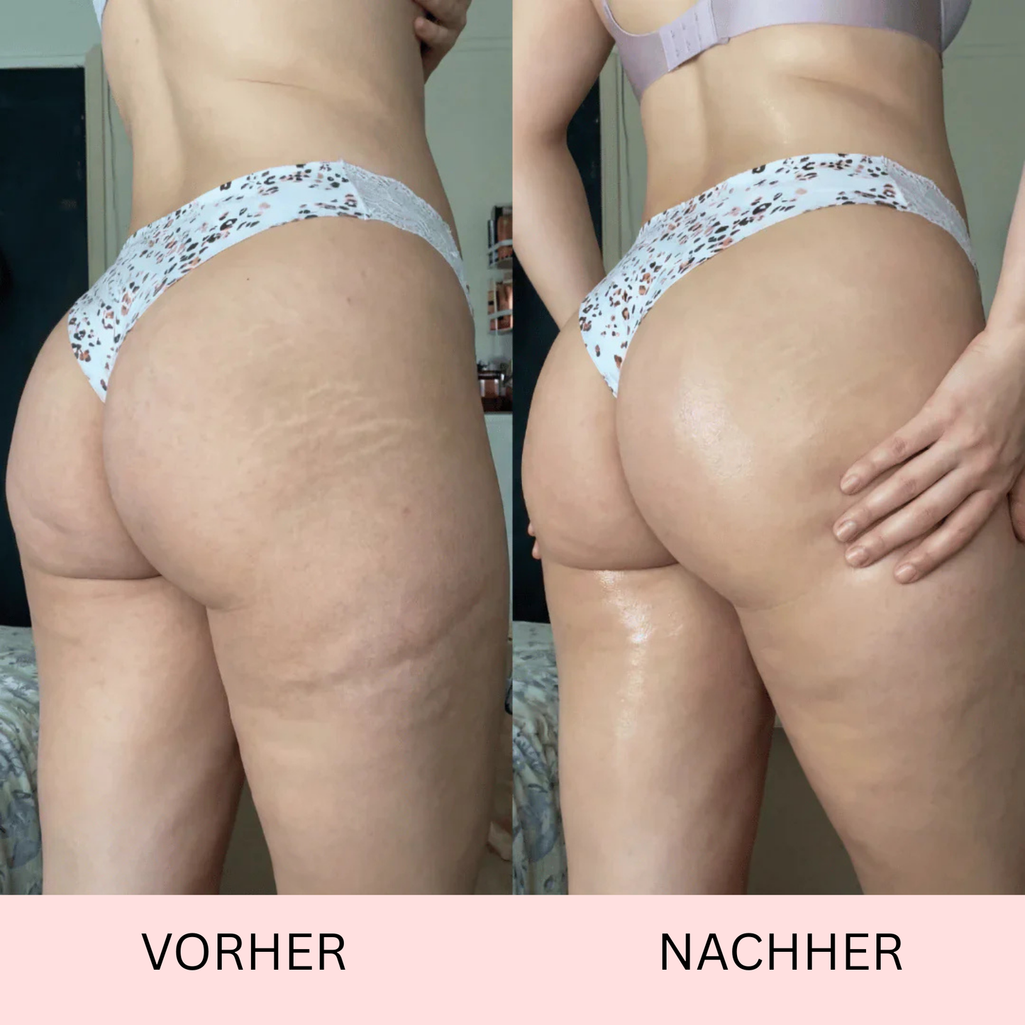 Anti-Cellulite-Massageöl