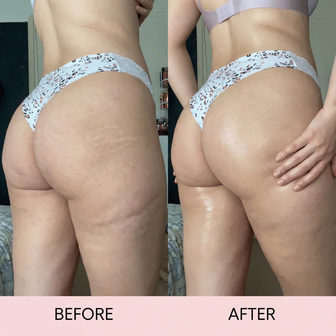 Anti-Cellulite-Massageöl