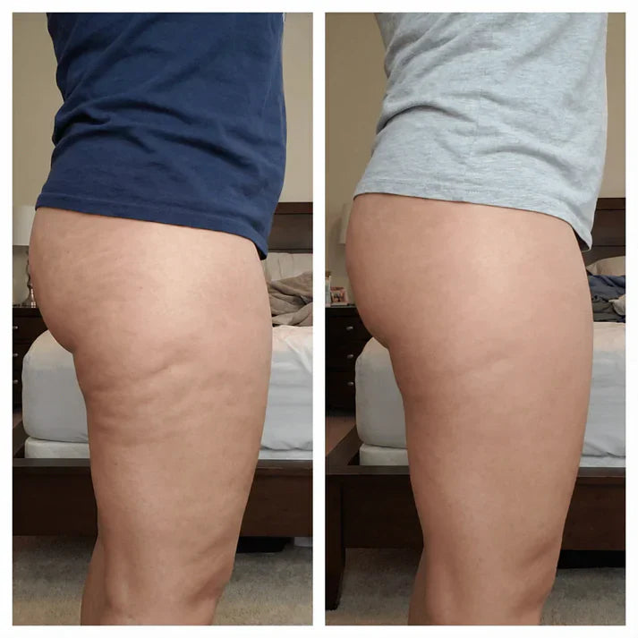 Anti-Cellulite-Massageöl